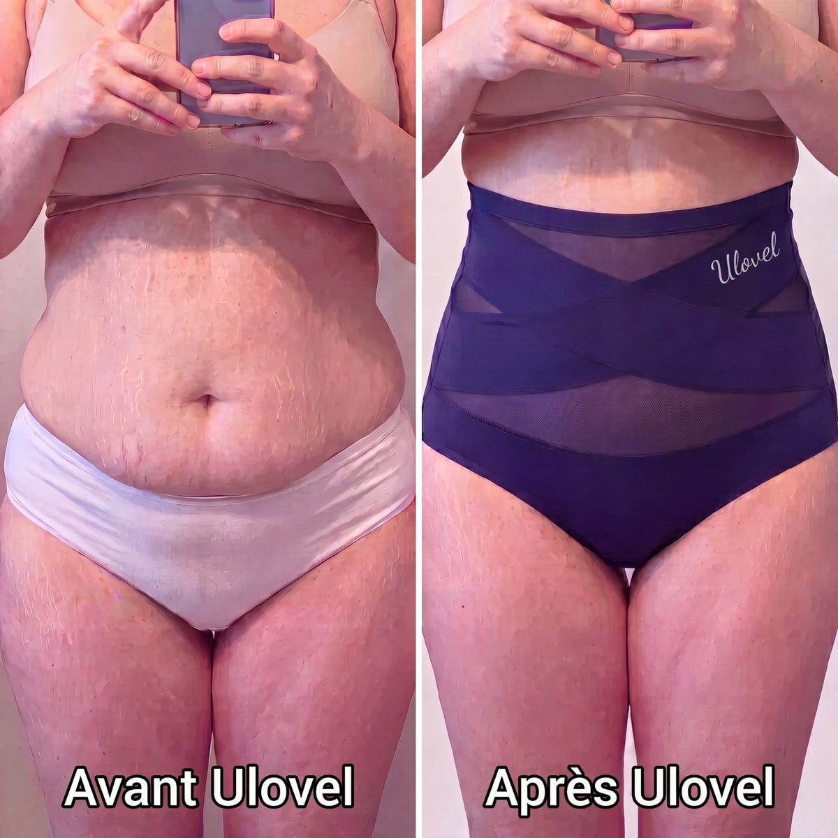 Avant et après Ulovel