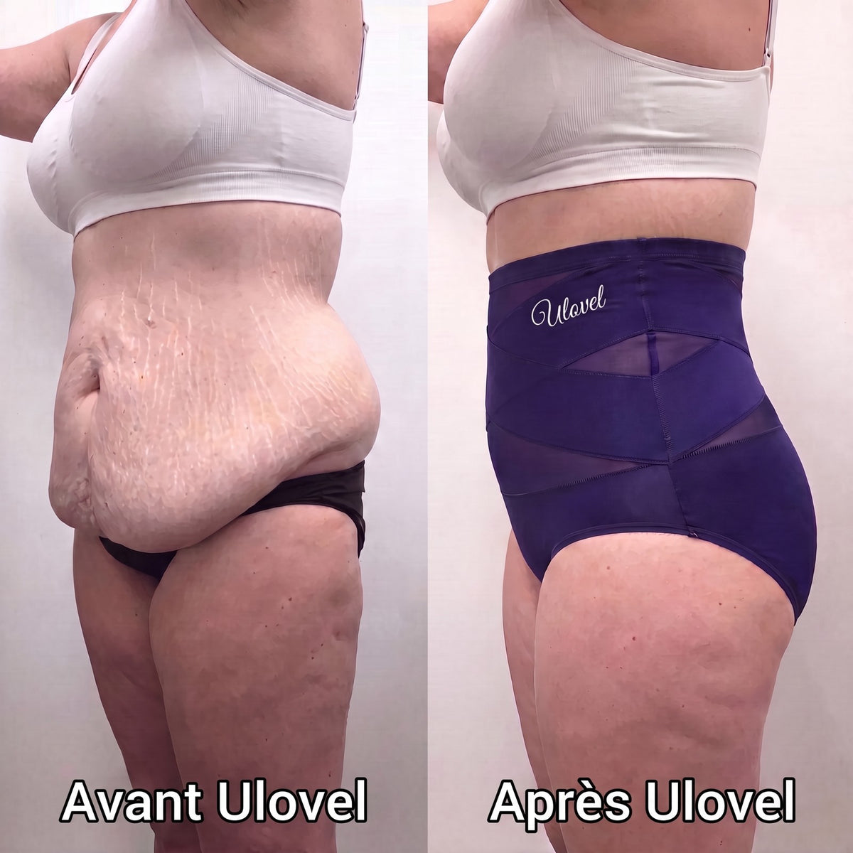 Avant et après Ulovel de profil